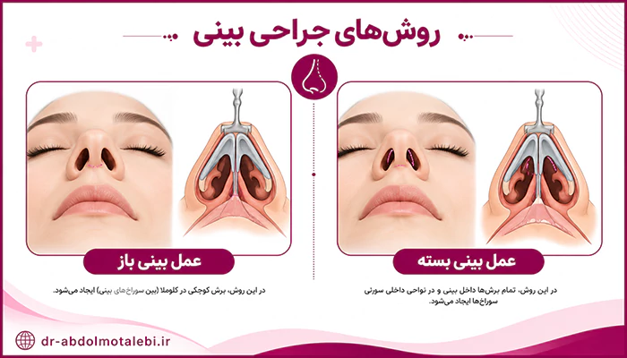 روش های جراحی بینی