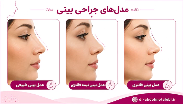 مدل های جراحی بینی