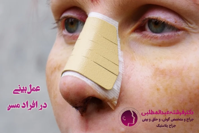 عمل بینی در سن بالا