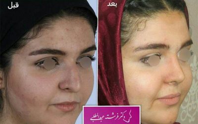 رابطه بین جراحی بینی و ارتودنسی