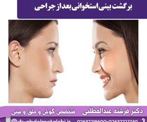 برگشت بینی استخوانی بعد از جراحی