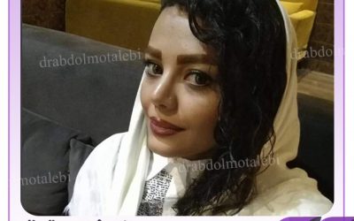 ورزش کردن بعد از جراحی بینی