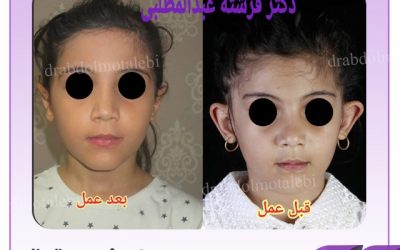 جراحی زیبایی گوش