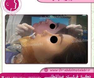 شستشو بینی بعد از جراحی چه اصولی دارد؟