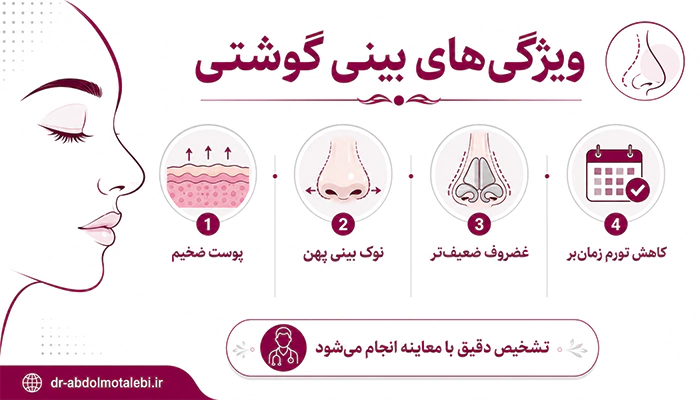 ویژگی های بینی گوشتی